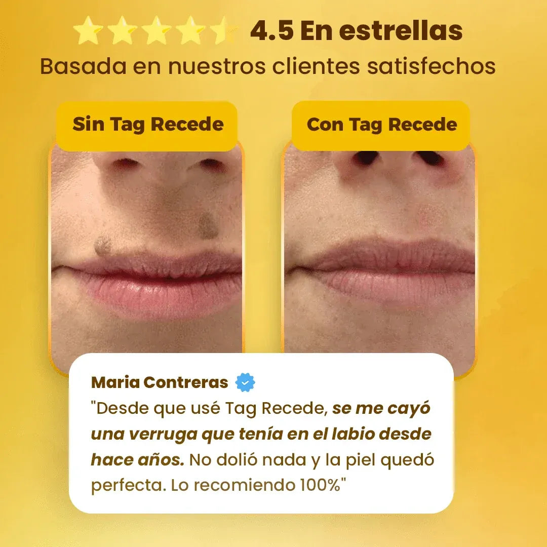 Eliminador de Verrugas Tag Recede® Original - Últimas 7 Unidades 🔥