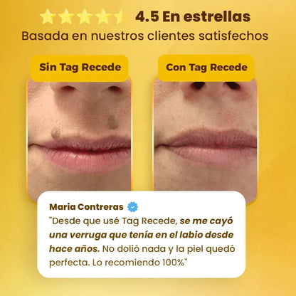 Eliminador de Verrugas Tag Recede® Original - Últimas 7 Unidades 🔥